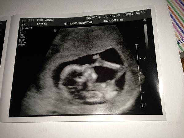 So...my gf is pregnant...-image-2021367893.jpg