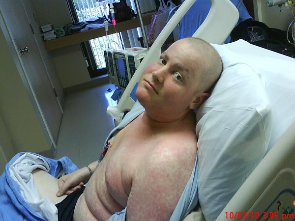 Andrew Casey's Cancer Battle-andrewdday.jpg